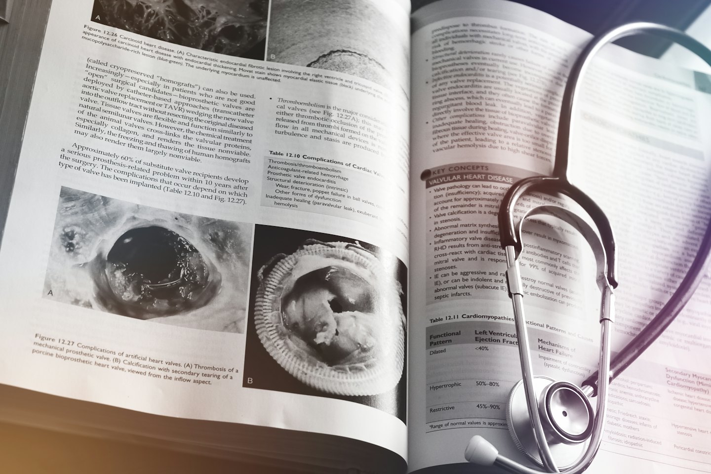 Manuale medico aperto con uno stetoscopio su una pagina.